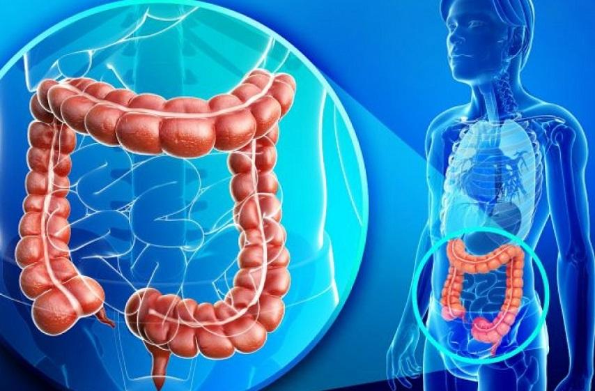 Casos de câncer de intestino avançam entre jovens e acendem alerta global